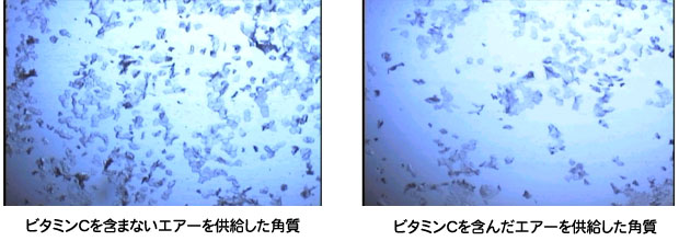 図4 皮膚の顕微鏡写真（倍率：400倍）